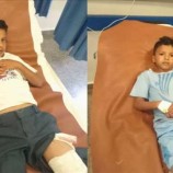 انفجار مقذوف حربي يتسبب في إصابة طفلين بتعز