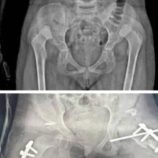 عملية نوعية.. تصحيح عيب خلقي لطفلة في مستشفى الشحر العام