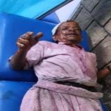 حوثي يحرق بائع مسن بالزيت المغلي في إب اليمنية