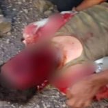 مخلفات الحوثي تصيب فتى بجروح خطيرة في محافظة تعز اليمنية