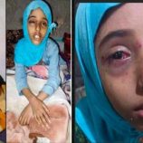 اعتداء على طفلة ووالدتها عقب شجار بين أطفال في محافظة إب اليمنية