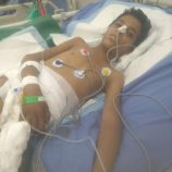 استشهاد الطفل عدي عبدالعزيز متأثرًا بإصابته برصاص قناص حوثي في كرش