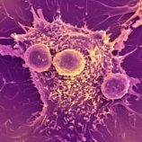 فيروس نباتي يحول المناعة إلى سلاح ضد السرطان