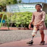 عدن.. مركز الأطراف الصناعية يقدّم خدماته لـ595 مستفيداً خلال يوليو المنصرم