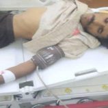 إصابة مواطن بلغم حوثي في محافظة الجوف اليمنية