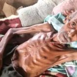 وفاة نازح مسن في مخيمات عبس بسبب سوء التغذية والإهمال الصحي