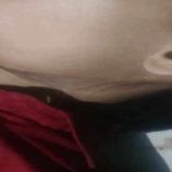 وفاة طفل بطريقة غامضة داخل مطعم في محافظة إب اليمنية