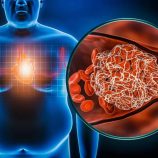 طفرة جينية تغيّر فهمنا لعلاقة السمنة بأمراض القلب   نتائج غير متوقعة قد تمهد الطريق لعلاجات أكثر أماناً