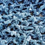 إثيوبيا تحذر من فيروس ماربورغ.. اليمن على رأس الدول المعرضة للخطر