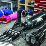 أطراف اصطناعية «أبدية»