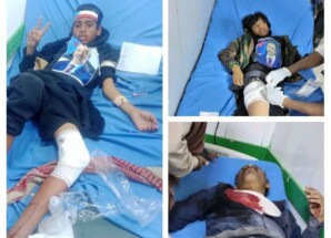 الشبكة المدنية تدين جرائم القتل التي ارتكبتها القوات الأمنية بحق المتظاهرين السلميين في محافظة شبوة