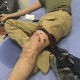 إطلاق رصاص على المتظاهرين السلميين في محيط قصر معاشيق