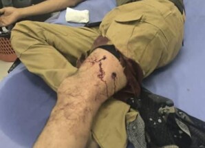 إطلاق رصاص على المتظاهرين السلميين في محيط قصر معاشيق