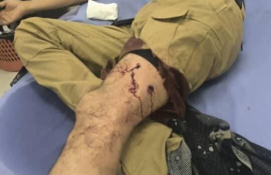 إطلاق رصاص على المتظاهرين السلميين في محيط قصر معاشيق