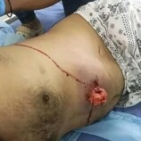 سقوط شهيد وعشرات الجرحى بإطلاق النار على متظاهرين سلميين من أبناء الجنوب أمام بوابة معاشيق