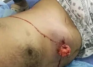 سقوط شهيد وعشرات الجرحى بإطلاق النار على متظاهرين سلميين من أبناء الجنوب أمام بوابة معاشيق