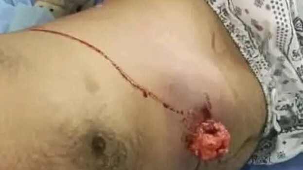 سقوط شهيد وعشرات الجرحى بإطلاق النار على متظاهرين سلميين من أبناء الجنوب أمام بوابة معاشيق