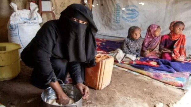 تقرير أممي: ثلث سكان اليمن يعانون سوء التغذية