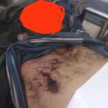 مقتل عامل برصاص قيادي حوثي في صعدة اليمنية