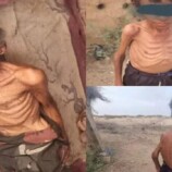 وفاة طفل ومسن جوعًا في مخيمات عبس بمحافظة حجة