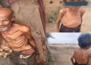 وفاة طفل ومسن جوعًا في مخيمات عبس بمحافظة حجة